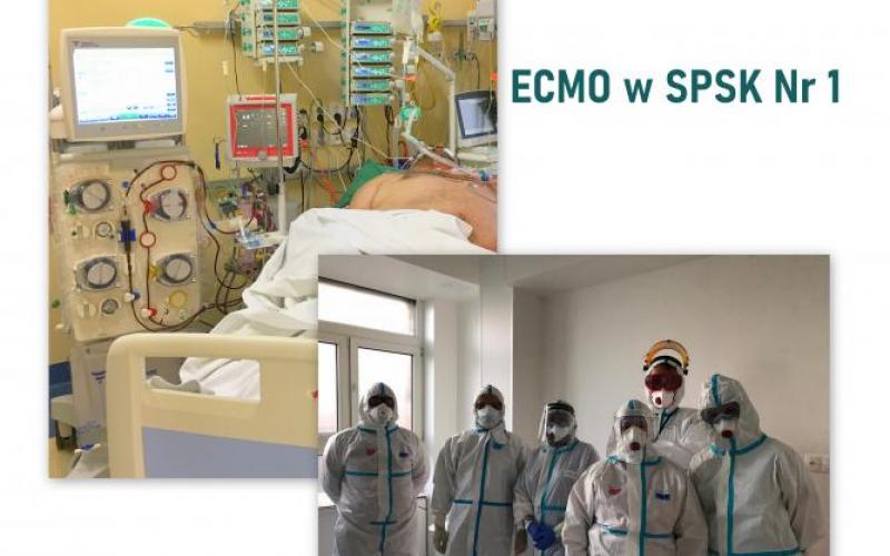 ECMO w SPSK Nr 1 / zespół wyjazdowy specjalistów z Kliniki Anestezjologii i Int. Terapii