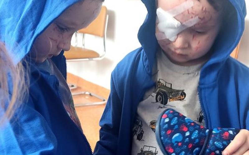 Timur i Nazar podczas hospitalizacji w SPSK Nr 1 (fot. A.Guzowska)